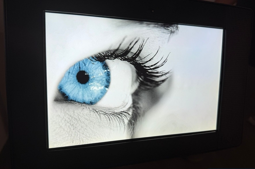 HOYA EyeGenius 3D-Opto-TV-Screen Komplettsystem – Ansicht 2